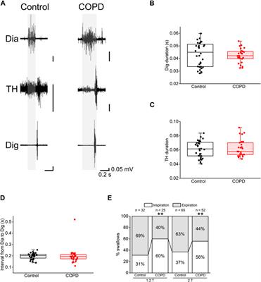 Physiological analyses of swallowing changes due to chronic obstructive pulmonary disease in anesthetized male rats